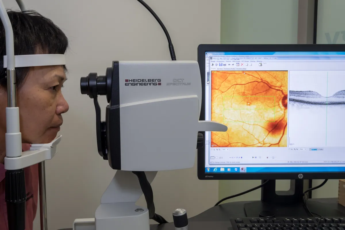 Patient using the OCT Spectralis